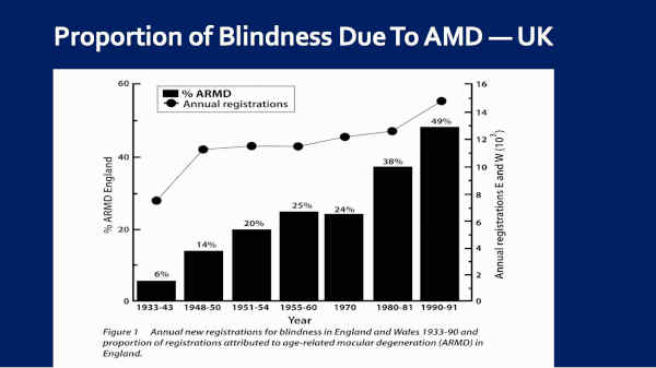 AMD and Blindness Prevalence Increasing in the U.K., 1930 - 1990