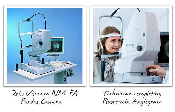 Fundus Camera and FA