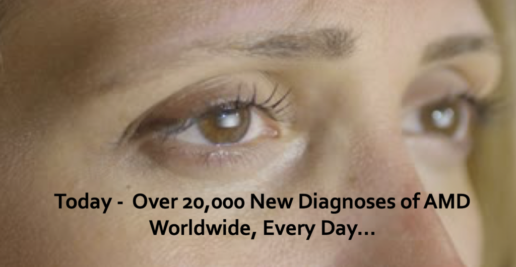 AMD Diagnoses Worldwide - Per Day