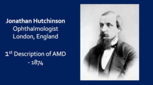 AMD First Described by Jonathan Hutchinson - 1874