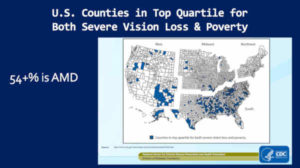 AMD Macular Degeneration and Processed Food Consumption Correlation, Poverty Increases Risk of AMD, USA CDC Data