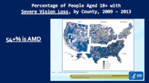 AMD Macular Degeneration and Processed Food Consumption Correlation, USA