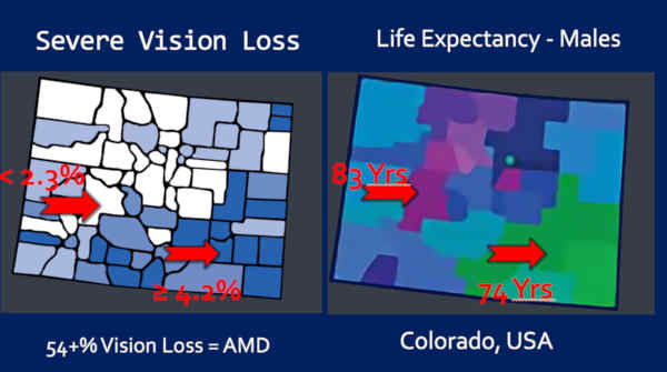 AMD Not a Disease of Aging? CDC Data USA