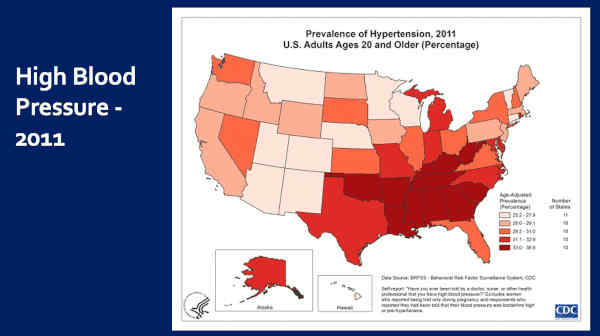 AMD Macular Degeneration Correlated to High Blood Pressure, USA CDC Data