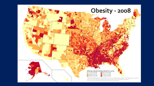 AMD Increased Prevalence and Obesity Correlation, USA CDC Data