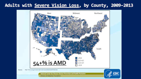 AMD Increased Prevalence and Processed Food Correlation, USA CDC Data