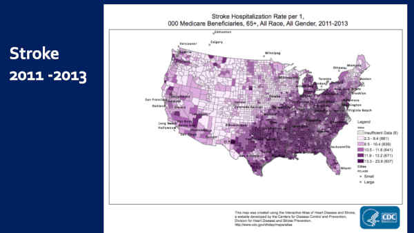 AMD Increased Prevalence and Stroke Correlation in the USA, CDC Data