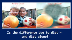 Diet and Age related macular degeneration