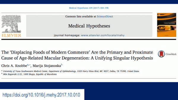 Displacing Foods of Modern Commerce are the Primary and Proximate Cause of Age related macular degeneration: A Unifying Singular Hypothesis