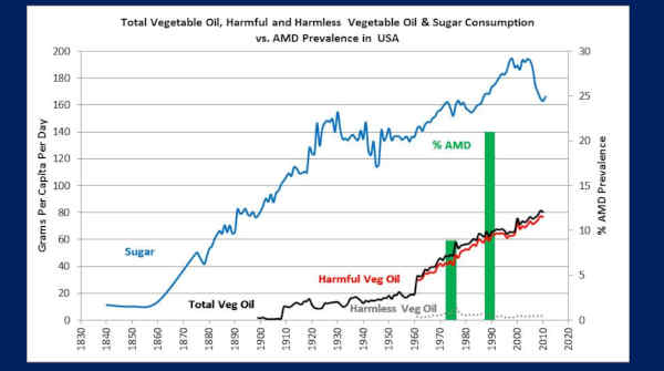 Macular Degeneration Versus Vegetable Oils and Sugar in the USA