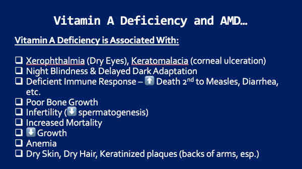 Macular Degeneration (AMD) and Vitamin A Deficiency