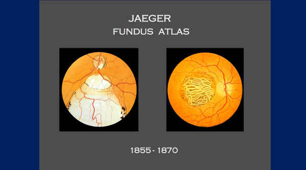 Retinal Atlases 19th Century