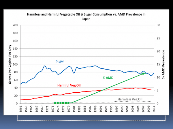 Processed foods and Increasing AMD Prevalence in Japan